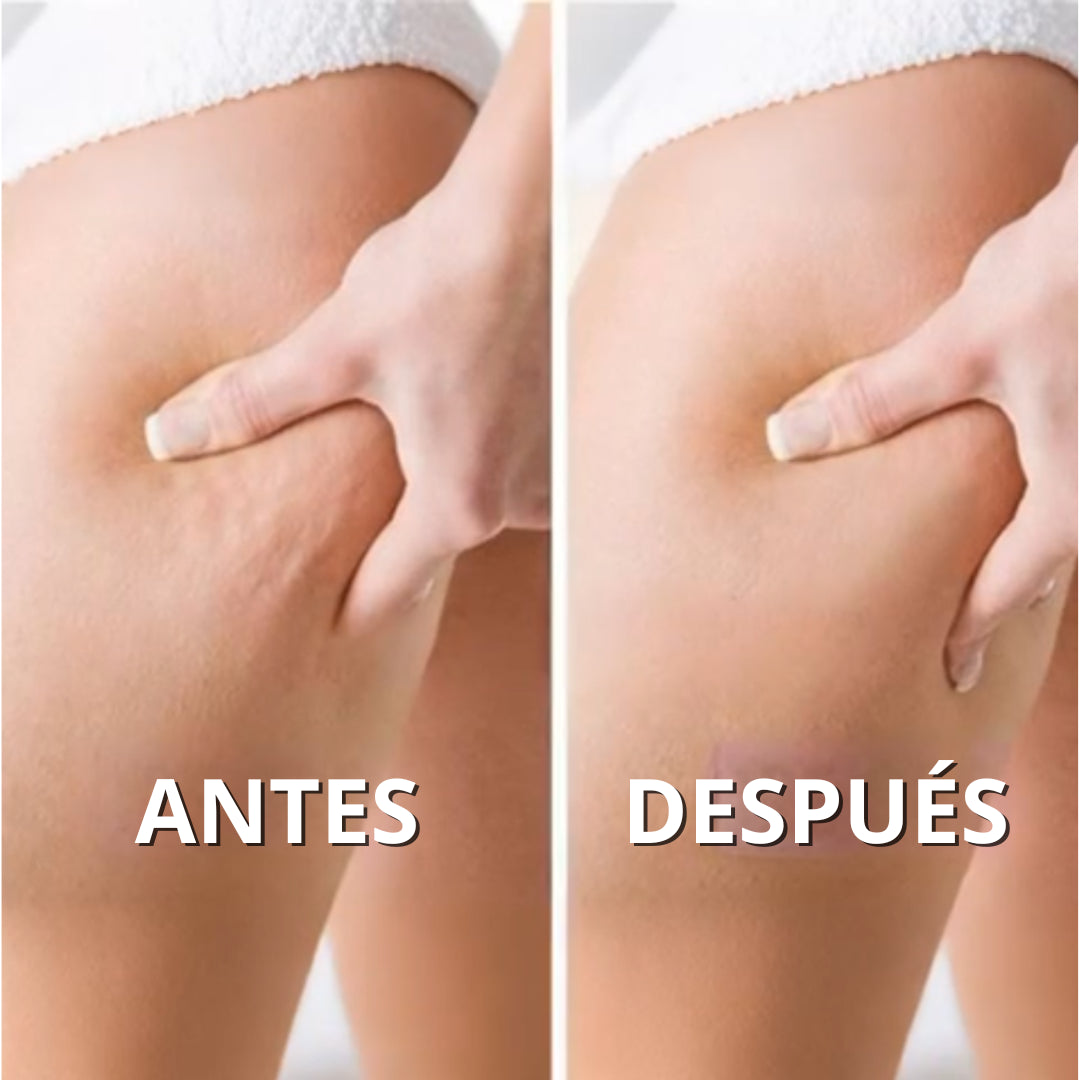 CeluliTech™ -  Elimina la celulitis y reafirma tu piel desde casa. *(Oferta Pre-Verano) +Envío GRATIS.