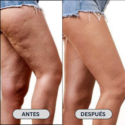 CerviLux™ – El único masajeador cervical que alivia de verdad en minutos (y también tonifica piernas y glúteos). (Oferta única hoy + Envío GRATIS)