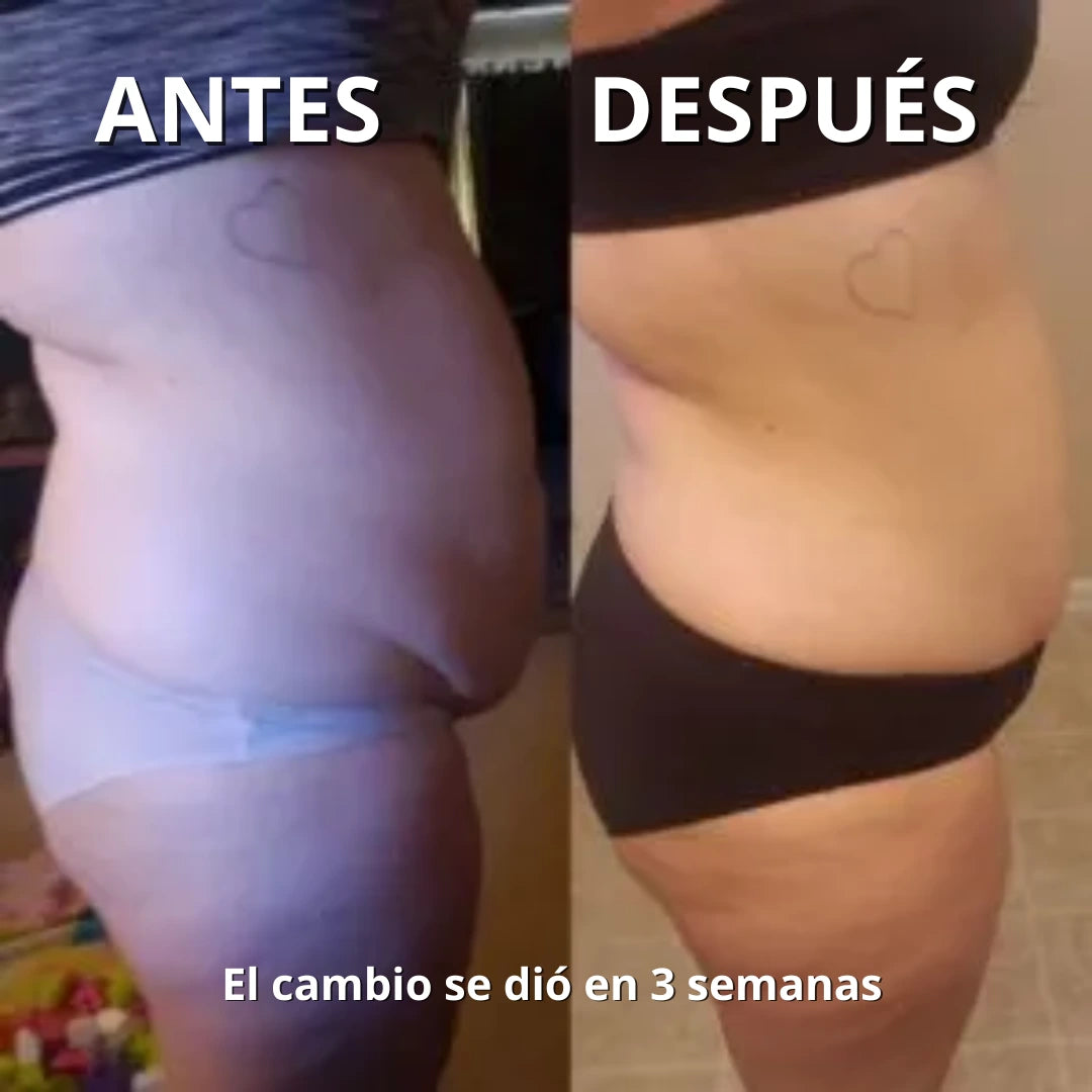 Dermaflux™ – Elimina la celulitis y reafirma tu piel desde casa. *(Oferta Pre-Verano) +Envío GRATIS.
